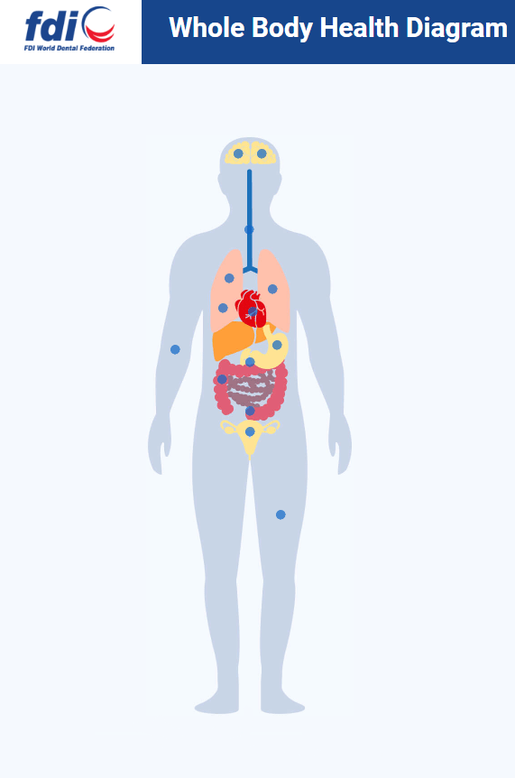 FDI Whole Body Health Diagram